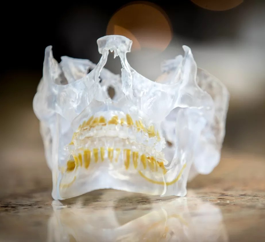 Jaw Surgery Jaw Surgery