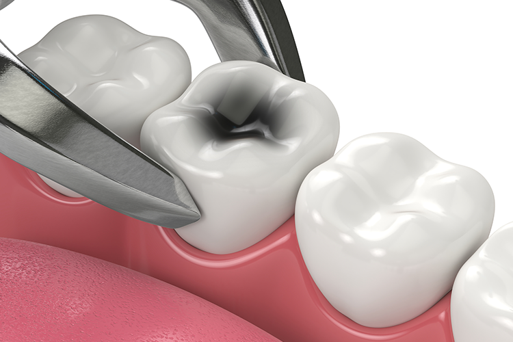 SoCal Oral and Maxillofacial Surgery